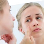 Some Acne Products Can Trigger Severe Allergic Reactions