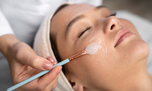 Chemical Peels
