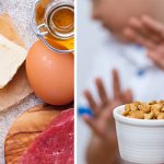Dealing with Food Allergies