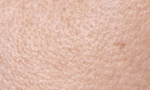 Minimize-the-Appearance-of-Pores