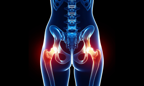What is Pudendal Neuralgia