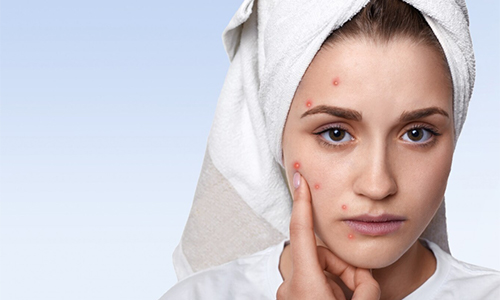Ferulic Acid for Skin Whitening